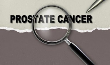 Καρκίνος του προστάτη: 9 οδηγίες για να μην εμφανίσετε ποτέ