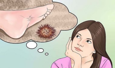 Πώς θα αφαιρέσω τα αγκάθια του αχινού από την πατούσα μου;