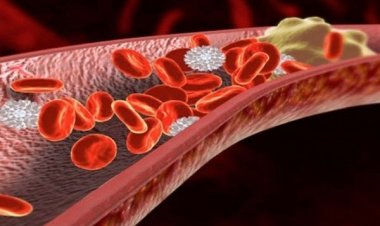 Η θρόμβωση προλαμβάνεται και θεραπεύεται