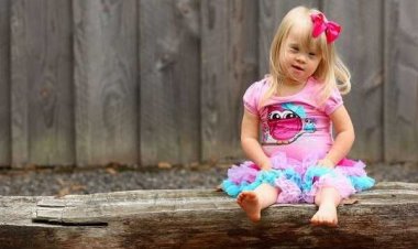 Παγκόσμια Ημέρα Συνδρόμου Down: «What I Bring To My Community» (Video)