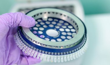 Coronavirus Pandemic: Ενημέρωση με 23 Ερωτήσεις & Απαντήσεις από το Ινστιτούτο Παστέρ για τις Διαγνωστικές Εξετάσεις Κορωνοϊού