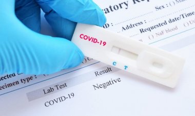 Coronavirus Travel: Τα rapid test σανίδα σωτηρίας για τον Τουρισμό!! Τι έδειξε η μελέτη στο Αττικόν για τα "γρήγορα τεστ ανίχνευσης κορωνοϊού"