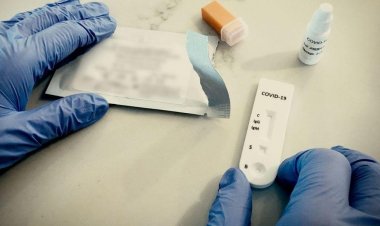 Coronavirus Pandemic: Με ποια συμπτώματα μπορείτε να κάνετε δωρεάν τεστ COVID-19 μέσω ΕΟΔΥ