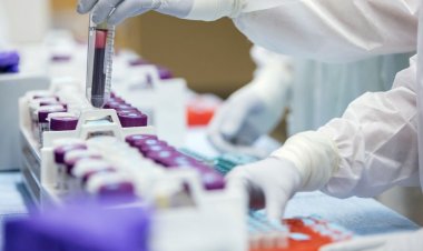 Coronavirus Pandemic : 97 νέα περιστατικά μόλυνσης το τελευταίο 4ήμερο - Στα 3.049 ο απολογισμός, Δύο νέοι θάνατοι