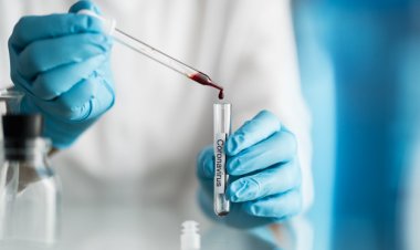 Coronavirus Testing: Διαγνωστικό τεστ αίματος για τον κορωνοϊό δίνει αποτέλεσμα σε 20 min