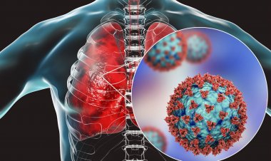 Coronavirus Disease: 2.556 νέα περιστατικά μόλυνσης –  207 νοσηλεύονται διασωληνωμένοι, 34 νέοι θάνατοι
