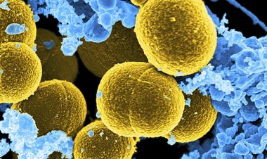 Coronavirus Disease:  916 νέα περιστατικά μόλυνσης –  527 νοσηλεύονται διασωληνωμένοι, 96 νέοι θάνατοι