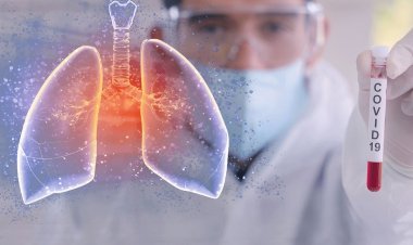 Coronavirus Disease: 1400 νέα περιστατικά μόλυνσης – 320 νοσηλεύονται διασωληνωμένοι, 27 νέοι θάνατοι