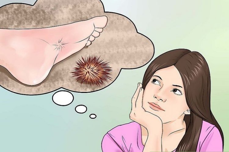 Πώς θα αφαιρέσω τα αγκάθια του αχινού από την πατούσα μου;