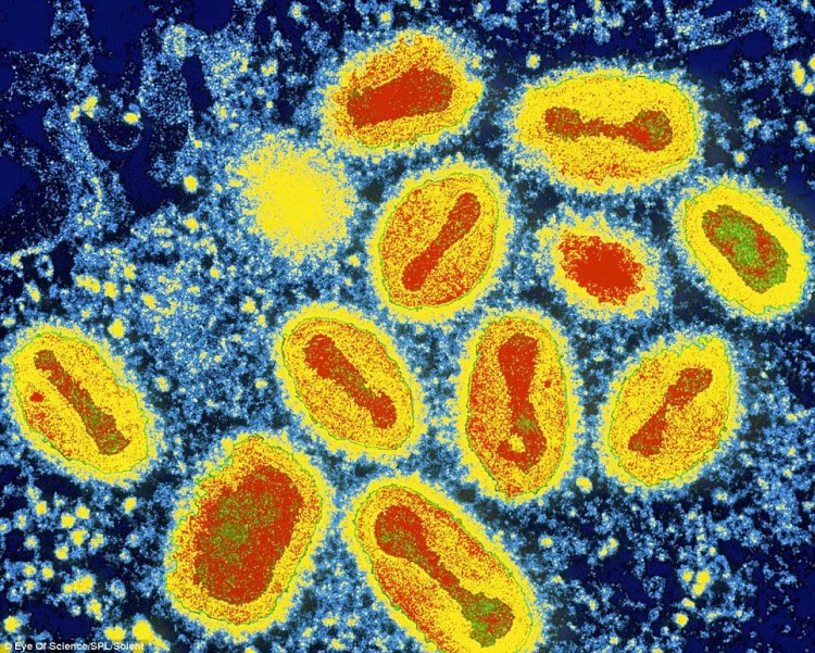 Coronavirus Disease: 408 νέα περιστατικά μόλυνσης – 89 νοσηλεύονται διασωληνωμένοι, 6 νέοι θάνατοι
