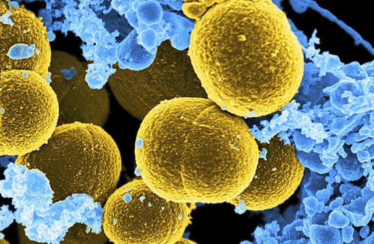 Coronavirus Disease: 1.698 νέα περιστατικά μόλυνσης –  392 νοσηλεύονται διασωληνωμένοι, 71 νέοι θάνατοι