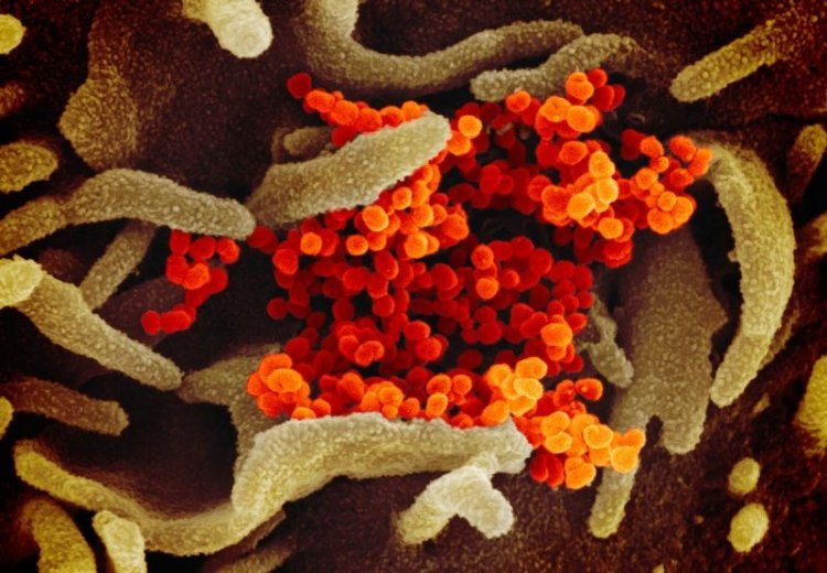 Coronavirus Disease: 1.044 νέα περιστατικά μόλυνσης – 600 νοσηλεύονται διασωληνωμένοι, 85 νέοι θάνατοι