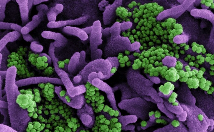 Dr. Fauci-Delta variant: Η παραλλαγή Δέλτα η μεγαλύτερη απειλή στην μάχη των ΗΠΑ για την εξάλειψη της πανδημίας εντός των συνόρων