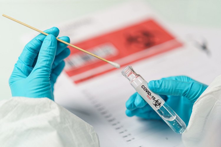 Covid-19 self-testing: Τέλος στον υποχρεωτικό Self testing έλεγχο από 1η Ιουλίου για τους εμβολιασμένους!! Σε ποιους επαγγελματικούς κλάδους συνεχίζονται!!