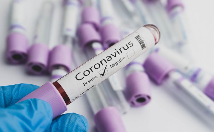 Covid-19 Curbs: Γιατί στην Επιτροπή Εμπειρογνωμόνων φοβούνται Νέο Κύμα και προτείνουν Μωβ Περιοχές & Διπλές Μάσκες!! Ποια μέτρα θα ισχύουν!!