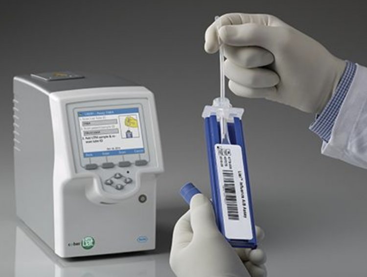  Covid PCR Testing: Πώς μπορούν να διατίθενται τα PCR σε τιμές κάτω του κόστους; Ανακοίνωση πέντε σωματείων
