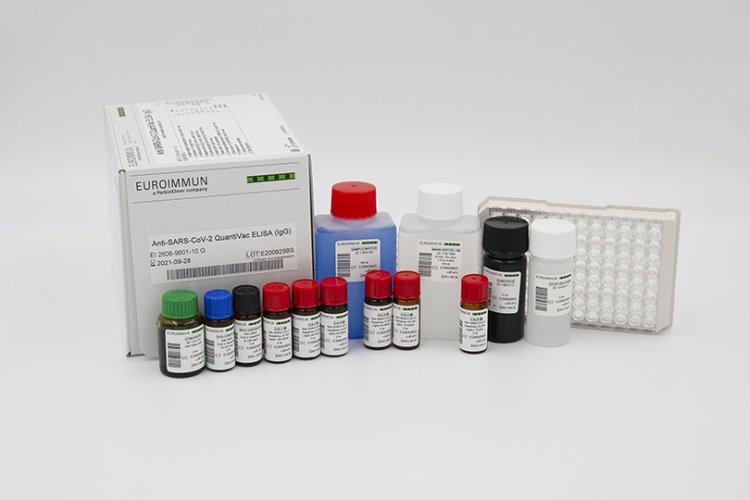 Anti-SARS-CoV-2 ELISA: Το νέο τεστ ELISA ανιχνεύει τα αντισώματα του κορονοϊού στα ούρα και όχι στο αίμα
