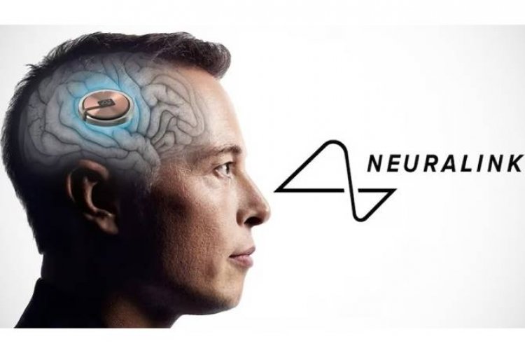 Elon Musk's Neuralink: Η Neuralink του Elon Musk έλαβε την άδεια από τον FDA για να δοκιμάσει εγκεφαλικά εμφυτεύματα σε ανθρώπους